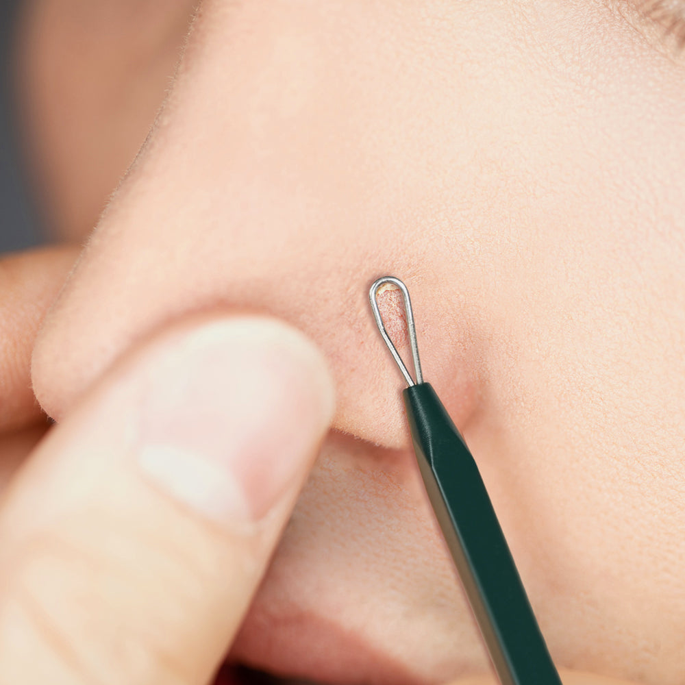PyunkangYul Pimple Extractor