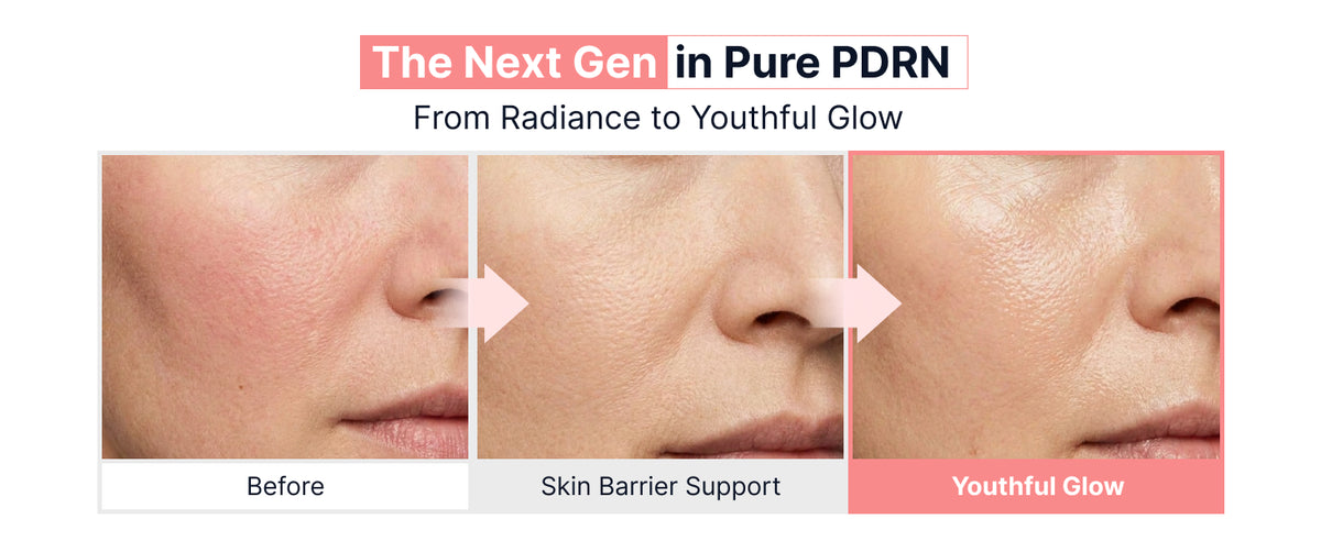 Sungboon Editor PDRN Pink Vitamin Glow Boosting Ampoule 35ml