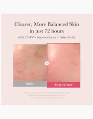 medicube TXA Niacinamide 15 Serum