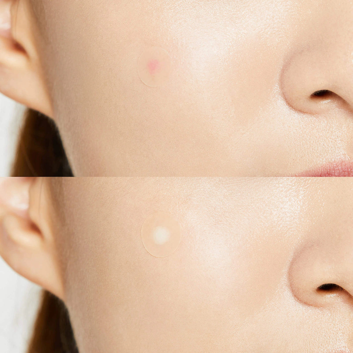 COSRX Acne Pimple Master Patch 24ea