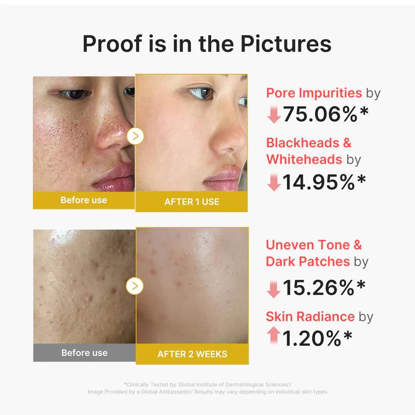 Medicube Kojic Acid Turmeric Peel Shot 80ml